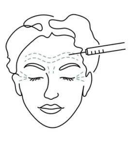 Botox