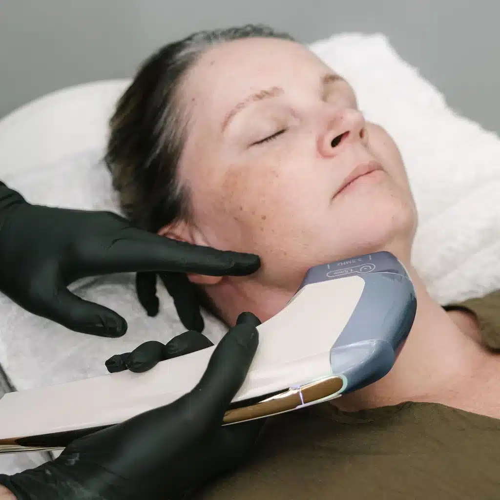 HIFU non-surgical skin tightening treatment at Skinworks in Durbanville using focused ultrasound technology to lift and firm the skin.